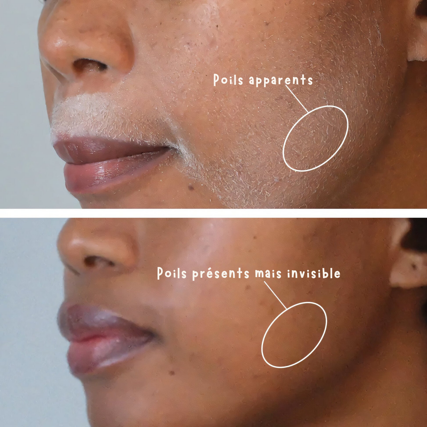 FacyGlow™️ - Spray éliminateur poils visage